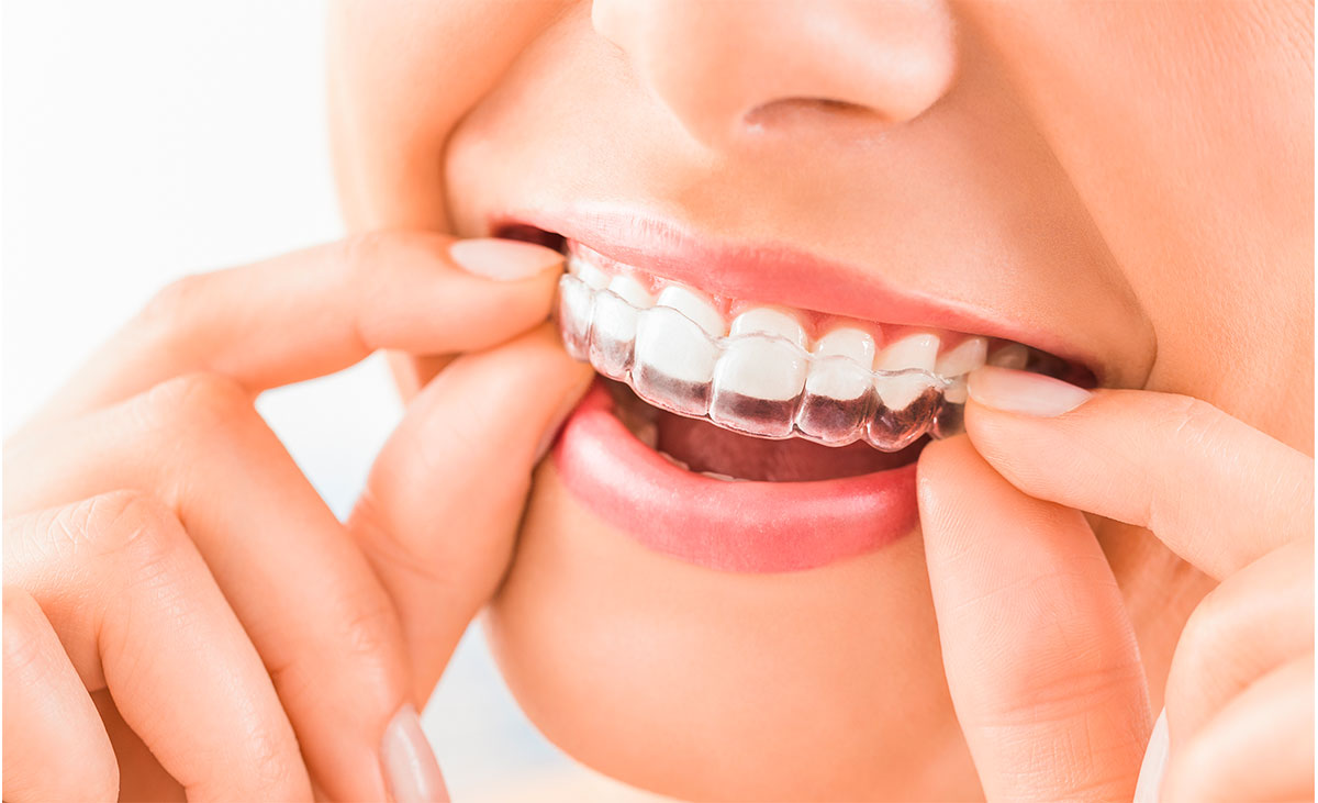 Soins dentaires - Dr Laure Clément - Dentiste Saint Marcellin